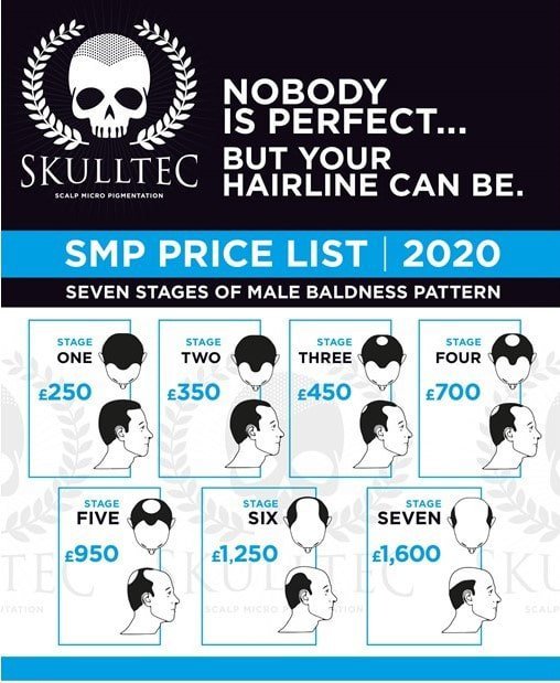 SMP Price