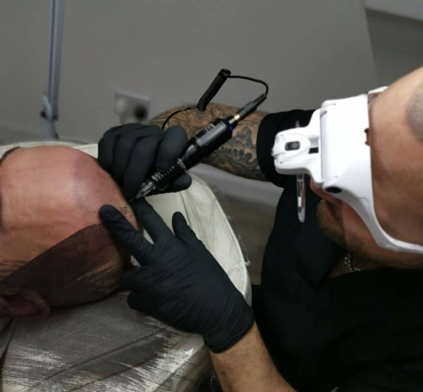 Scalp micropigmentation training