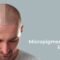 Navigating Scalp Micropigmentation Regrets: Expert Advice