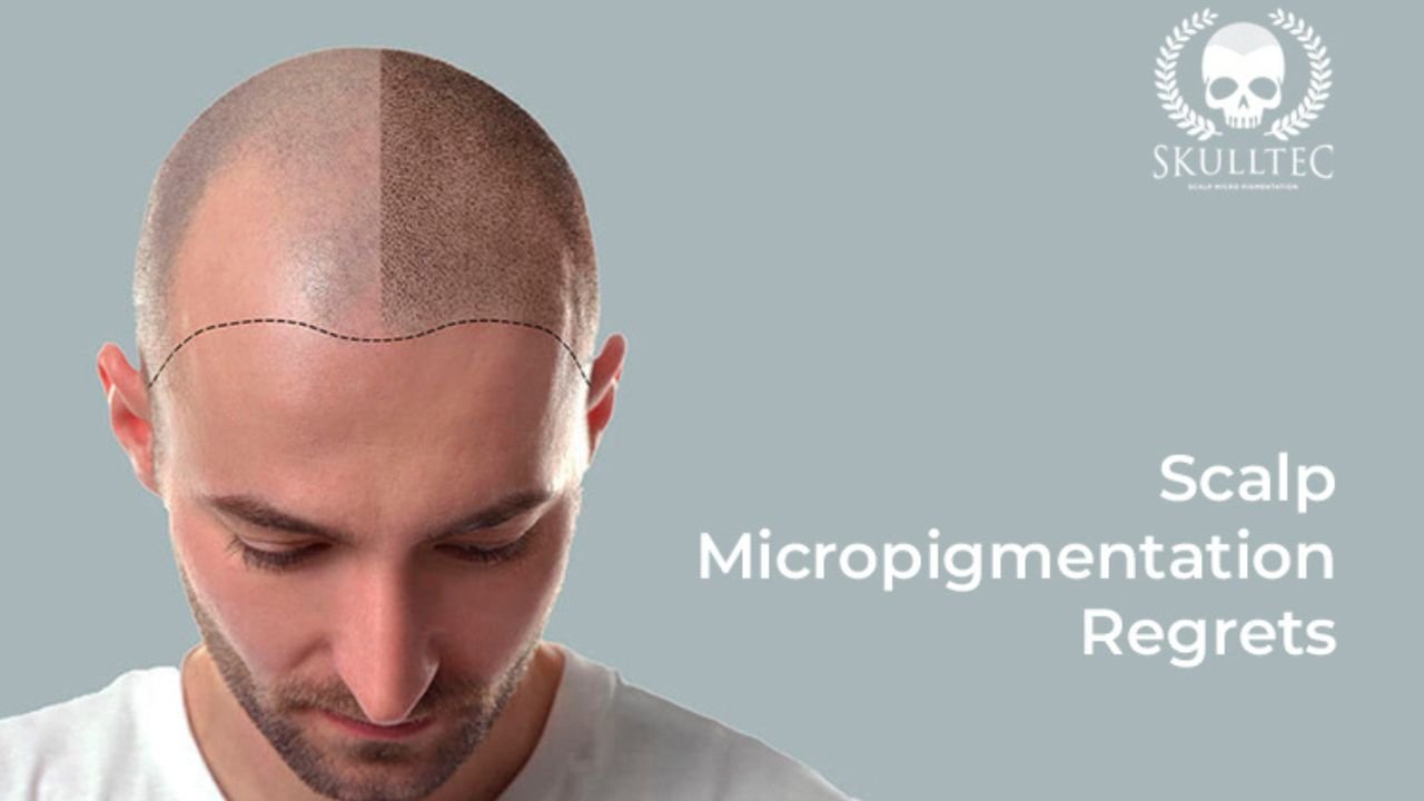 Navigating Scalp Micropigmentation Regrets: Expert Advice