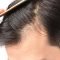 Best Hair Fall Solution | Skulltec