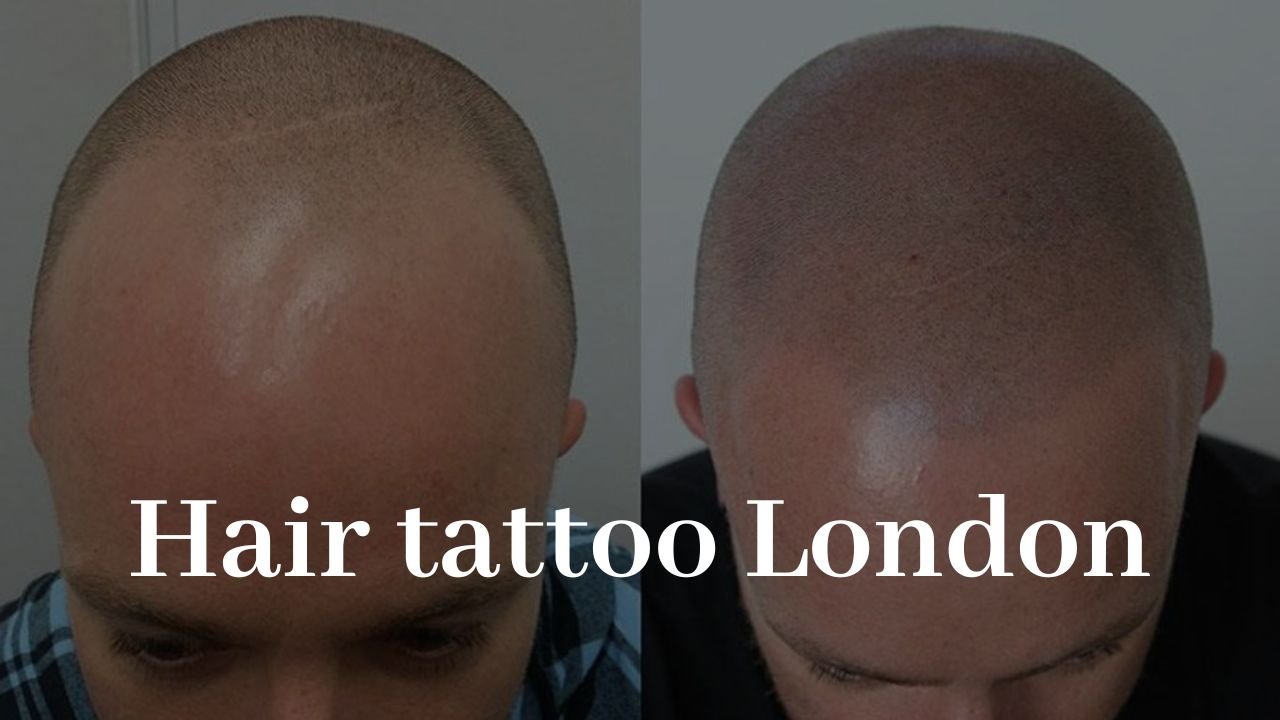 Extreme optical illusion tattoo makes man's bald head look like a gaping  hole - Daily Star