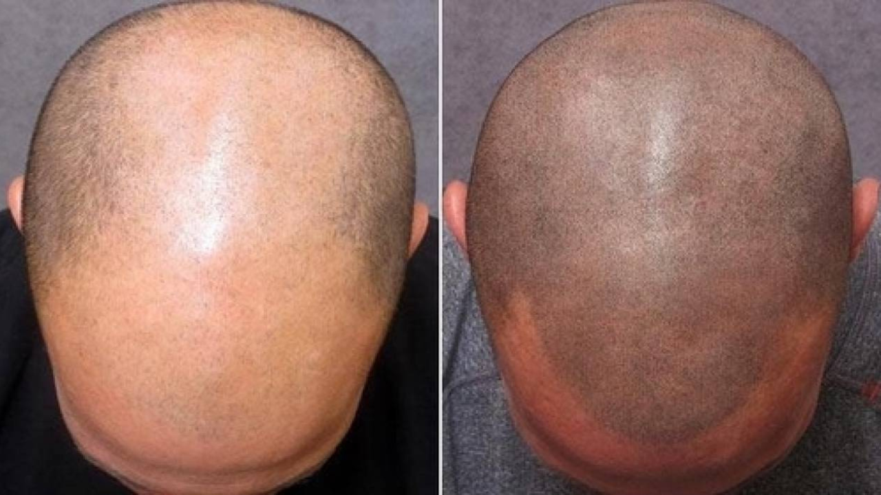 Hair-Tattoo-vs-Body-Tattoo