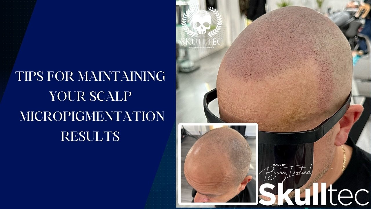 Tips for Maintaining Your Scalp Micropigmentation