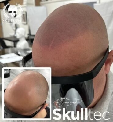 cost of hair tattooing