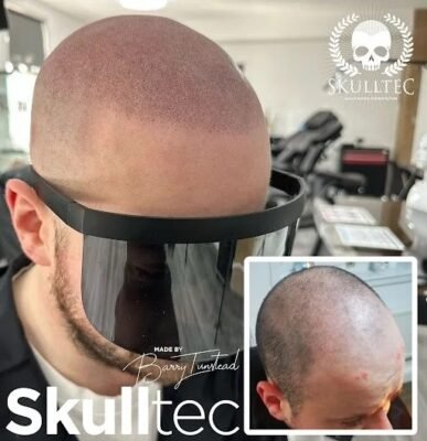 Micropigmentation London