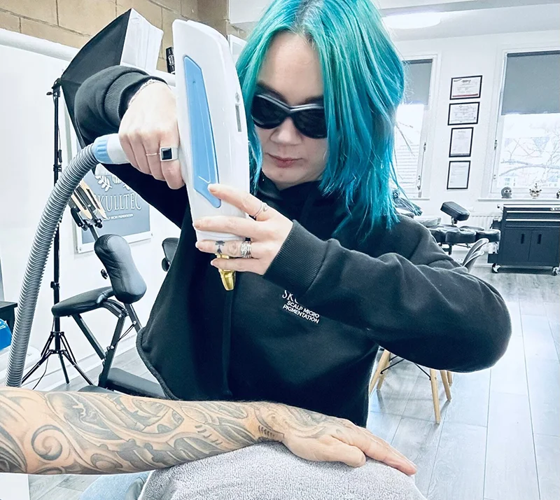 laser Tattoo Removal Glasgow
