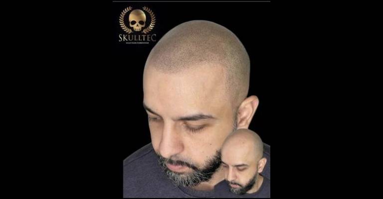 Hairline Tattoos for Men